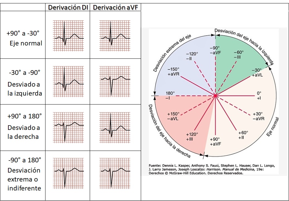 Determinación del eje eléctrico