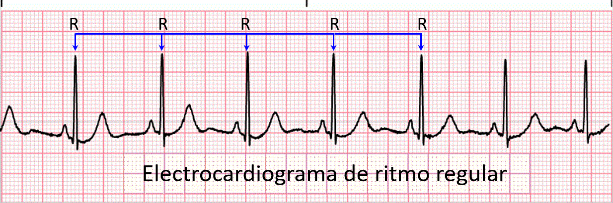 EKG ritmo regular