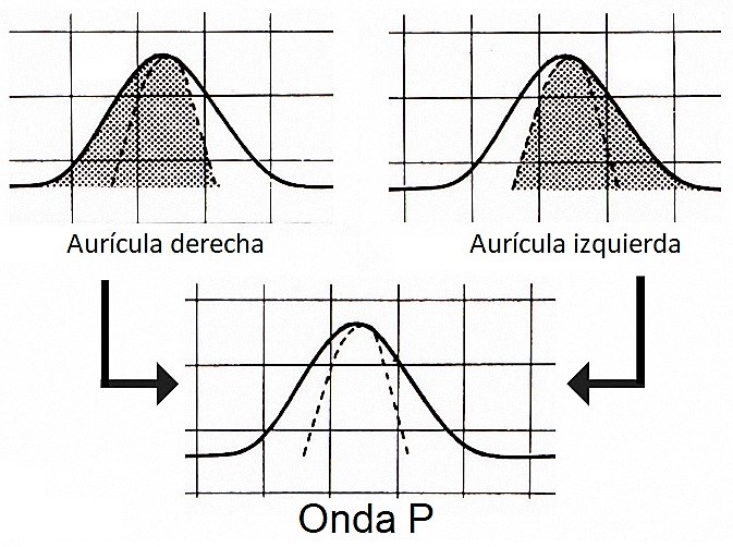 Generación de la onda P