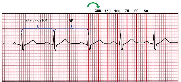 Determinación de la frecuencia cardíaca con el número 300
