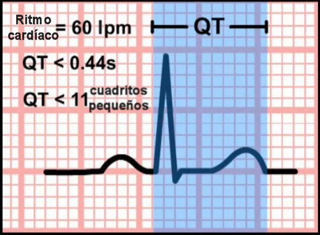 Intervalo QT