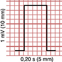 Calibración del electrocardiografo