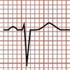 QRS negativo