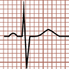 QRS isobifásico